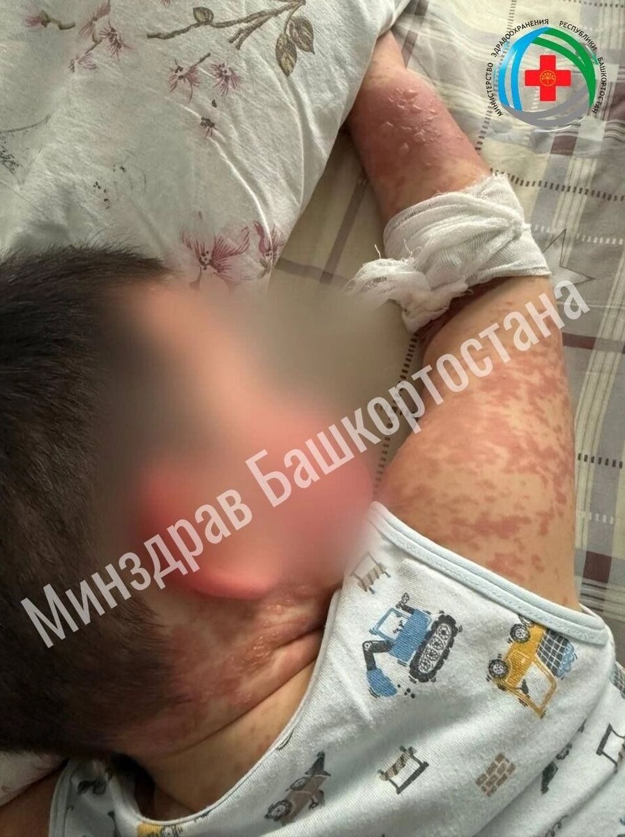     Источник: @DrRakhmatullin