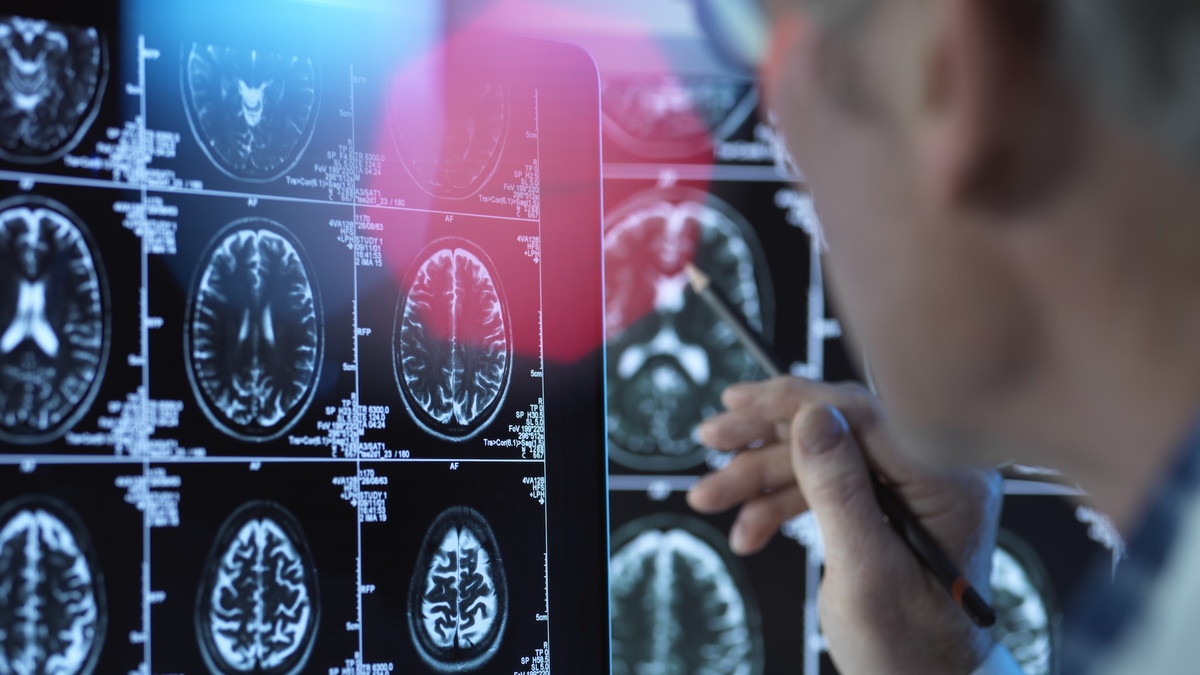    Три случая смертельной болезни мозга в Орегоне шокируют ученых