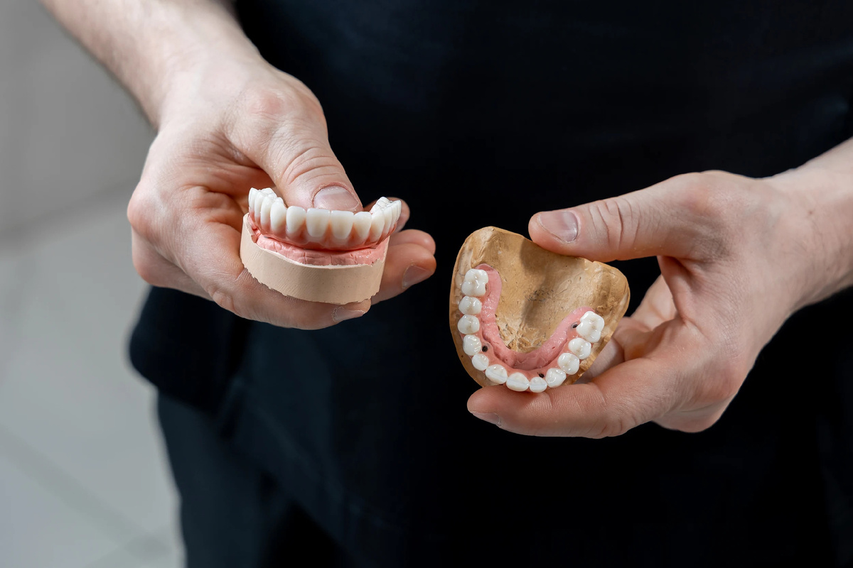 Условно-съёмные протезы на имплантах (All-on-4)