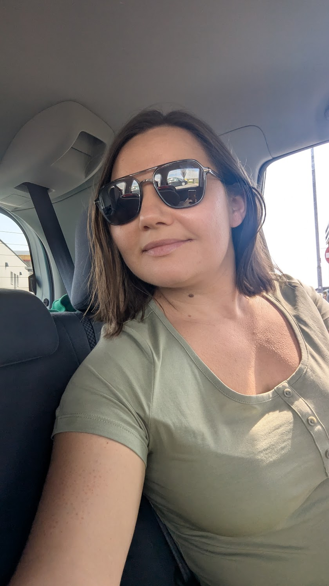 Вот тут видно хорошо — это не аллергия, не высыпания. 