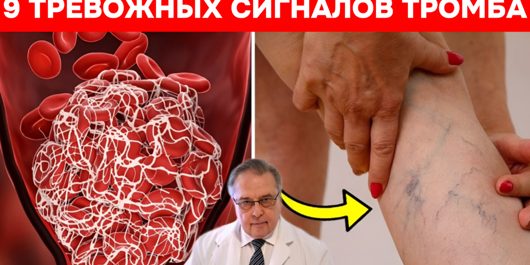9 тревожных сигналов тромба: как ваш организм пытается предупредить вас