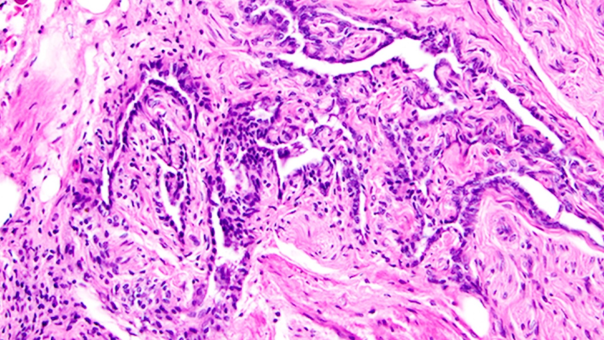    Забытый орган в женском теле оказался ключом к фертильности