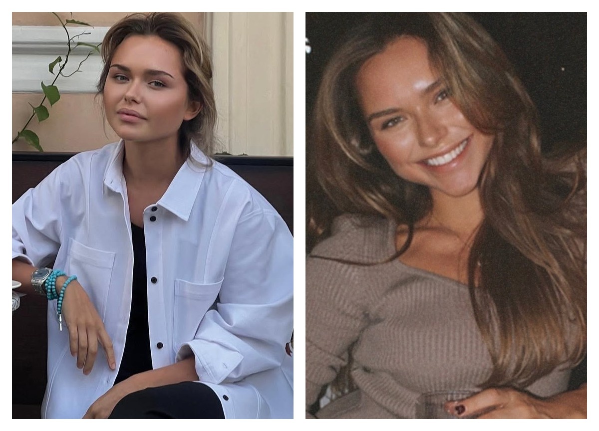 Фото слева до пластики, справа после филлеров