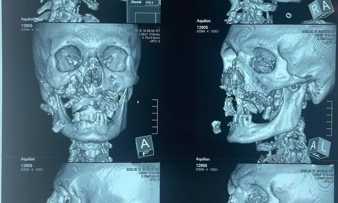    Фото пресс-службы минздрава Хакасии Ольга Чистова