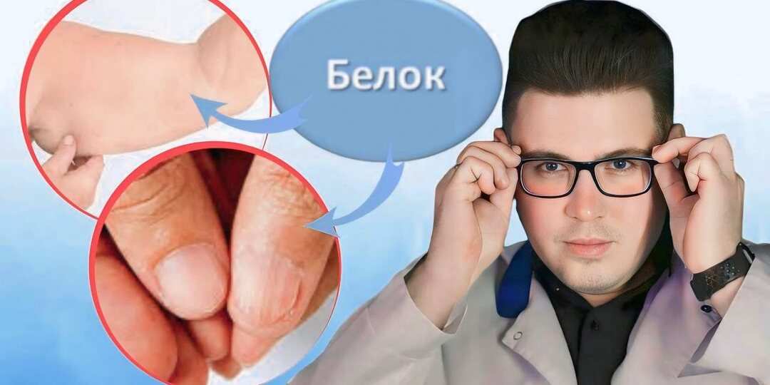 Почему недостаток белка в организме опасен : 10 симптомов дефицита, о которых мало кто знает