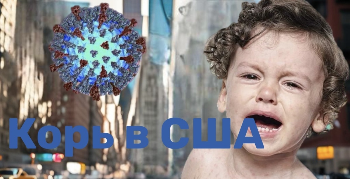 Крупнейшая вспышка кори в США с 2000 года