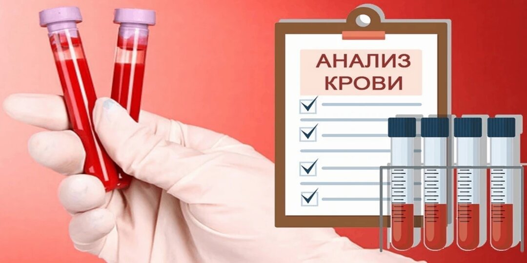 Что показывает общий анализ крови: расшифровка без страшилок