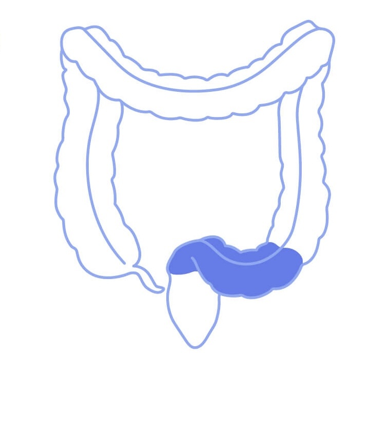 Сигмовидная кишка