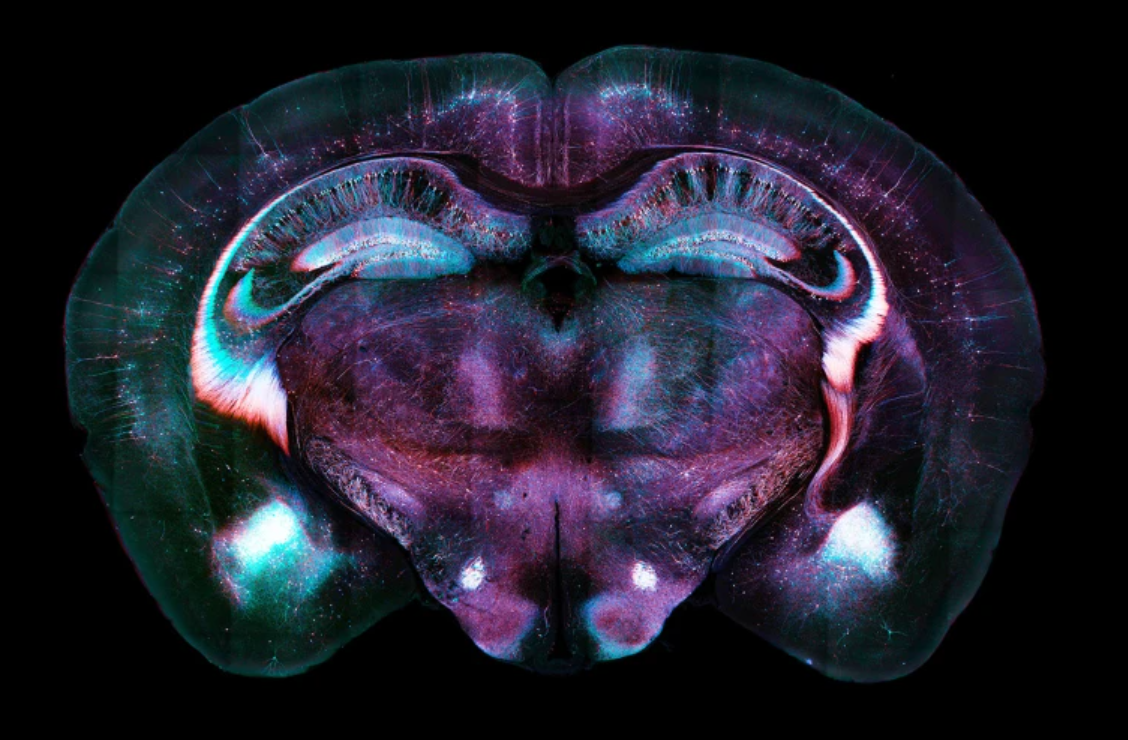 Срез мозга мыши, на котором видны нейронные клетки, помеченные флуоресцентными белками. Фото: Arthur Chien/Science Photo Library  📷
