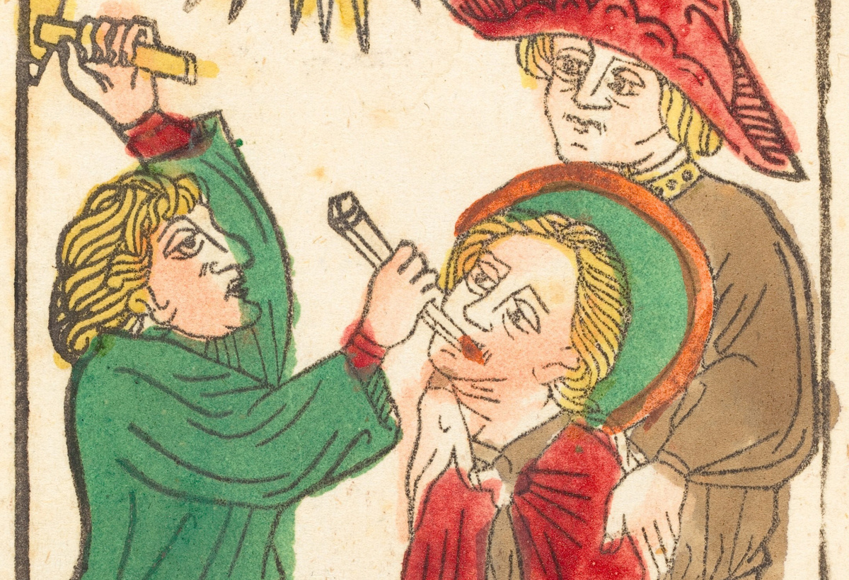     Фото: Heritage Art/Image State/East News В те времена зубы удаляли часто