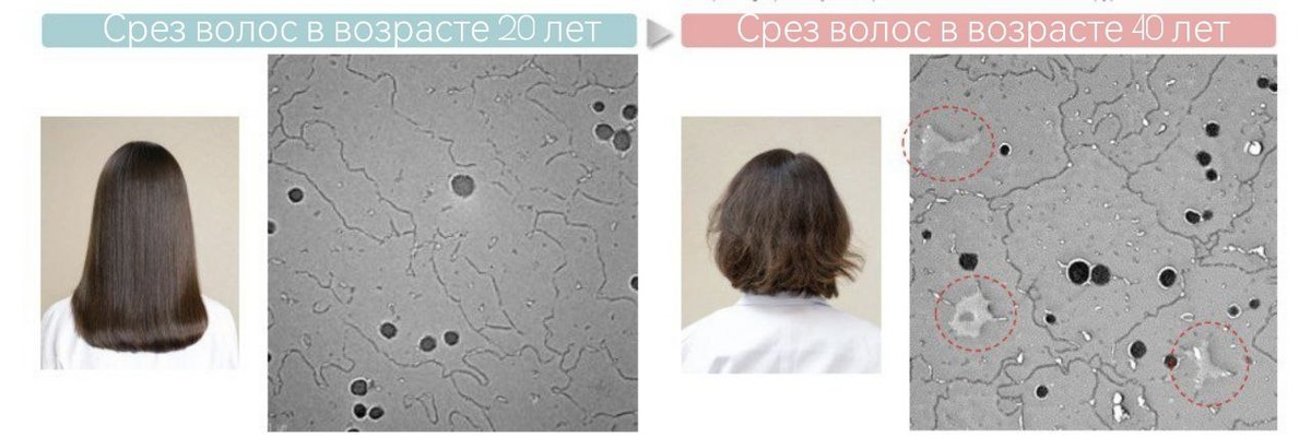 С возрастом начинают расти волосы с меньшей плотностью кератина. Из-за снижения плотности структура волос становится более гидрофильной, и внутренний баланс волос нарушается.
