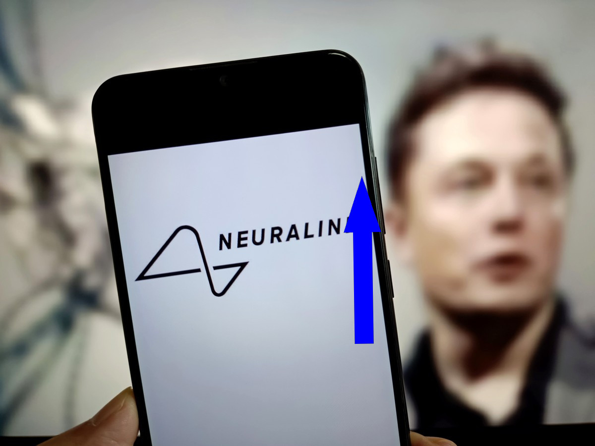    Нейроимпланты Neuralink Илона Маска открывают двери в эпоху цифрового сверхчеловека