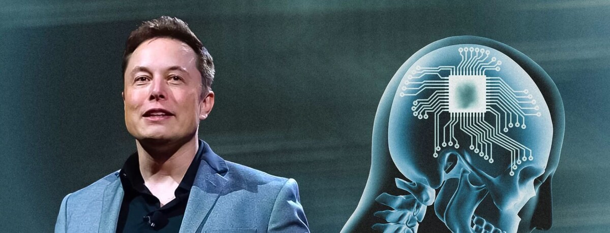    Нейроимпланты Neuralink Илона Маска открывают двери в эпоху цифрового сверхчеловека