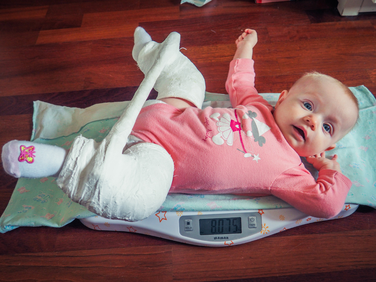 27 марта 2019 года. Вес вместе с гипсом - 8075 г