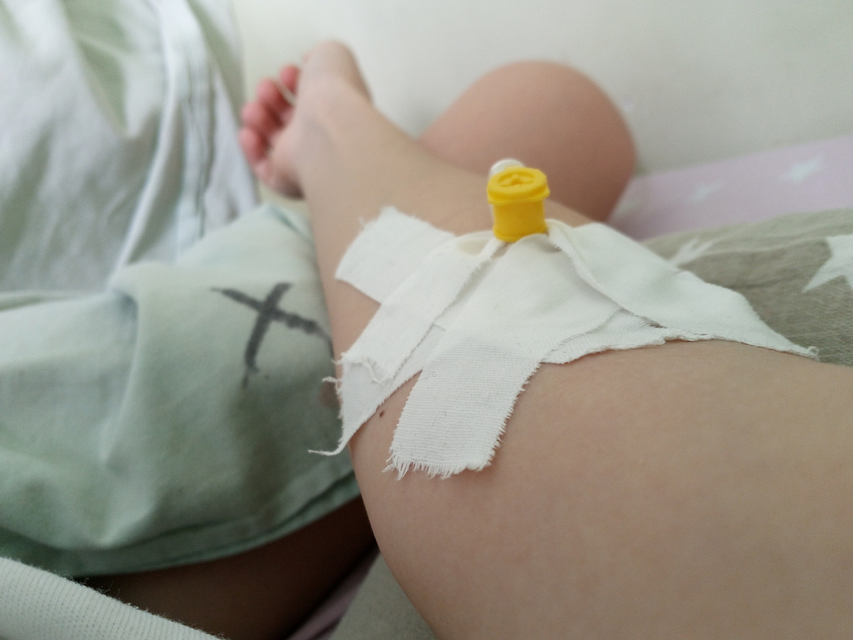 Это фото после операции тут катетер 