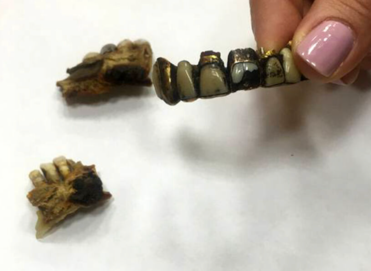    Фрагмент челюсти фюрера Адольфа Гитлера, которая хранится в архиве ФСБ России / Источник: ©Telegram-канал «МеркачеваПрава»