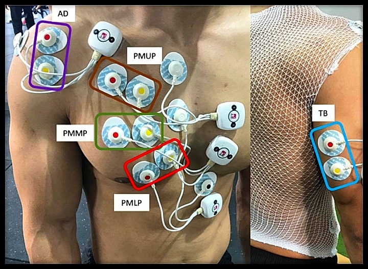 ЭМГ-электроды. Источник www.PabMed.com