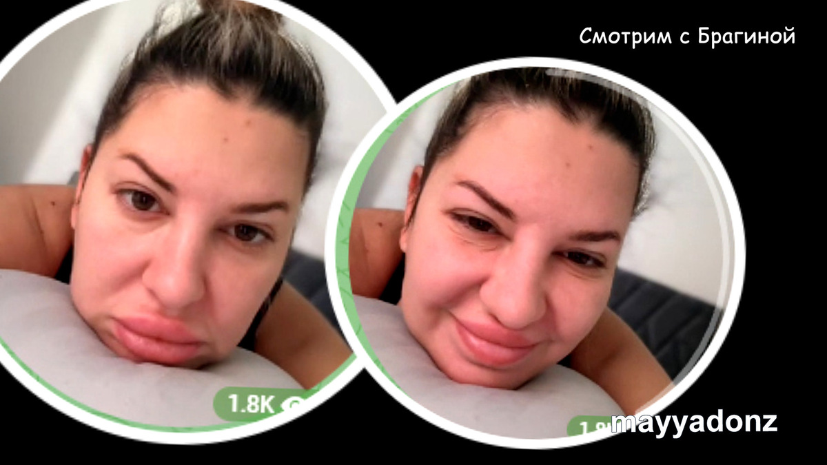 Фото: соцсети. Майя Донцова после операции. Теперь всё будет хорошо