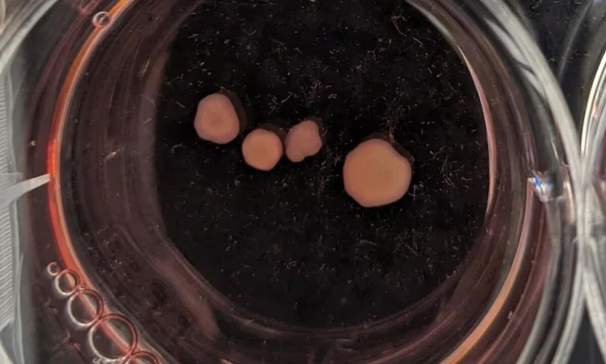 Органоиды на 82 день развития