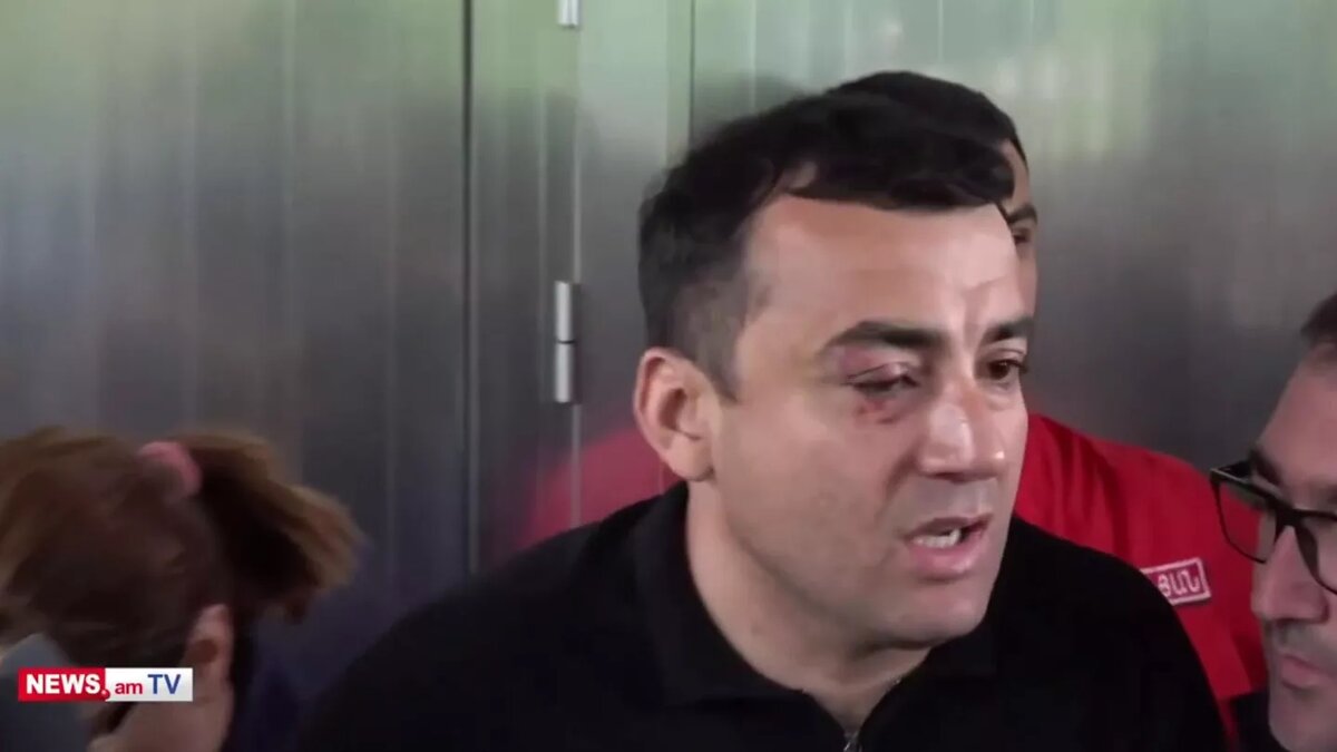 © Photo : Screenshot