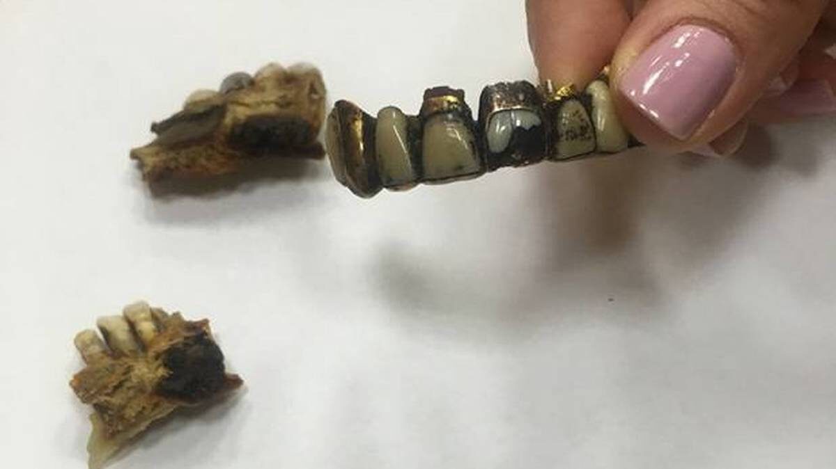    Челюсть Адольфа Гитлера / Фото: Telegram / МеркачеваПрава