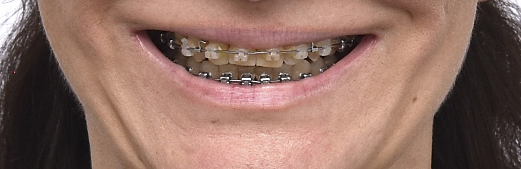 На фото результат, за который врачу, цитирую, "не стыдно".