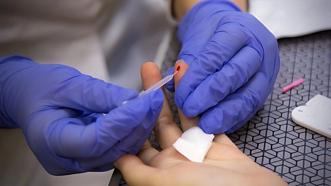     Источник: 1MI