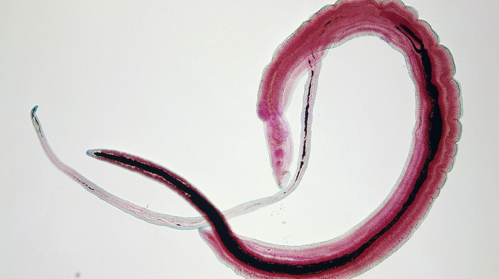    Паразитический червь увеличивает риск рака шейки матки