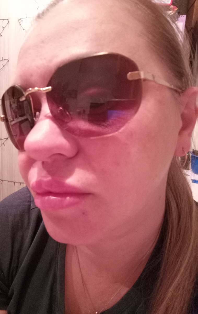 Кожу вокруг глаза сожгла-таки, переусердствовала, восстанавливаю теперь