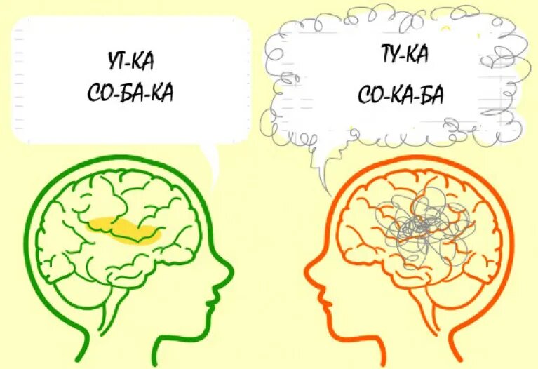 Дислексия - избирательное нарушение способности к овладению навыками чтения и письма при сохранении общей способности к обучению.