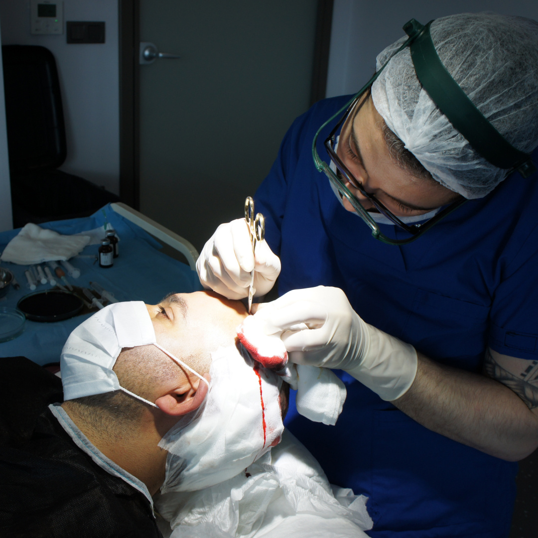 Пересадка волос в сертифицированной клинике