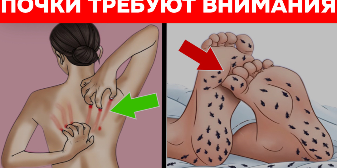 Они молчат, пока не сломаются: 11 признаков, что ваши почки кричат о помощи