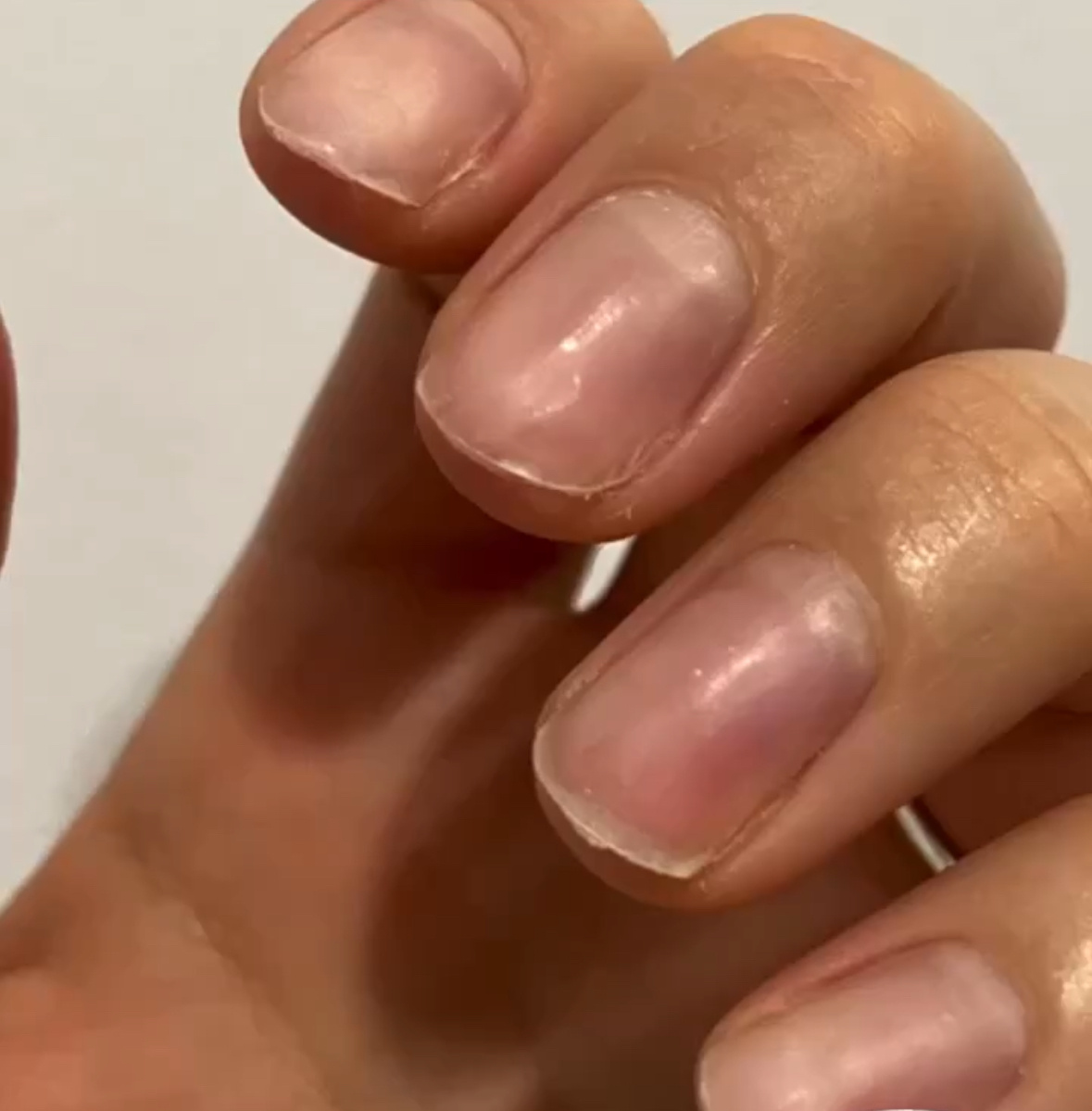 Красные участки на ногтях - это спиленные до ложа ногти, своя арка ногтя - 50% круга, от которого ничего не осталось, потому что мастер думала - это база, когда пилила настоящий ноготь. Прикасаться к ним было больно. 