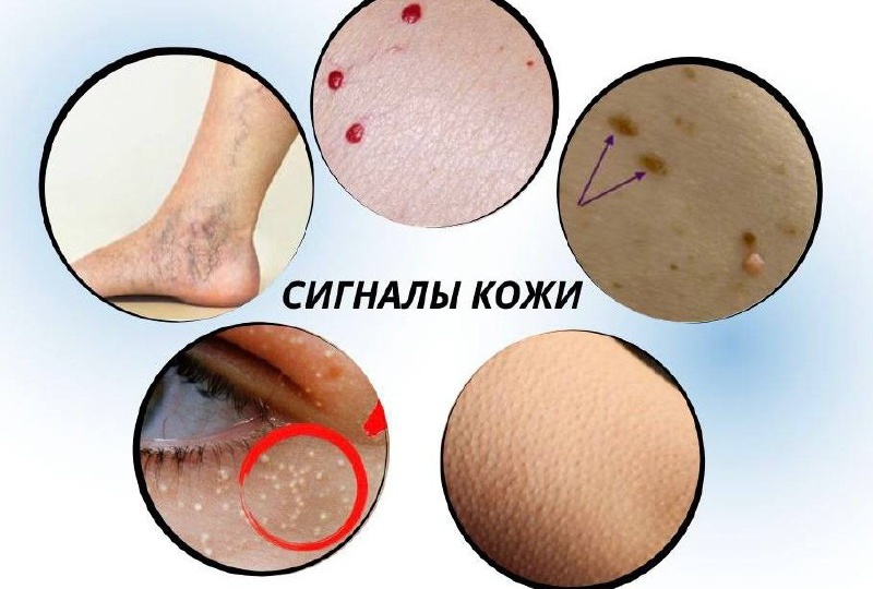 5 тревожных сигналов кожи, которые нельзя игнорировать без визита к врачу