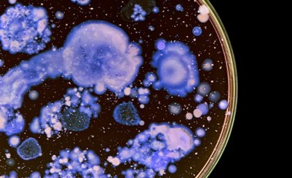 Бактерии растут в чашке Петри. Изображение: Adobe
