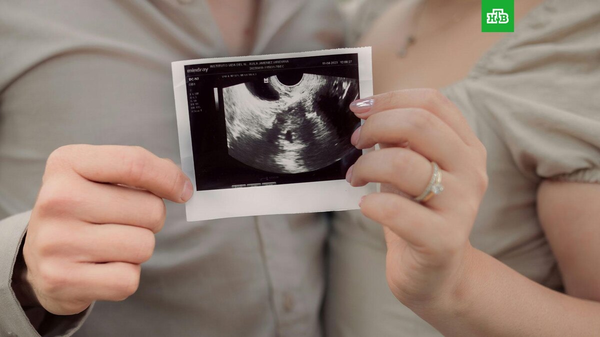    Фото: Melanie Rosillo Galvan / unsplash.com