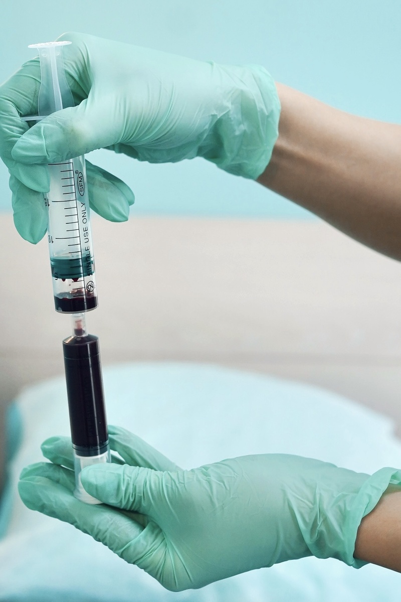 PRP-терапия (плазмотерапия) волос – эффективная процедура против выпадения, стимулирующая рост новых волос за счет инъекций обогащенной тромбоцитами плазмы вашей крови