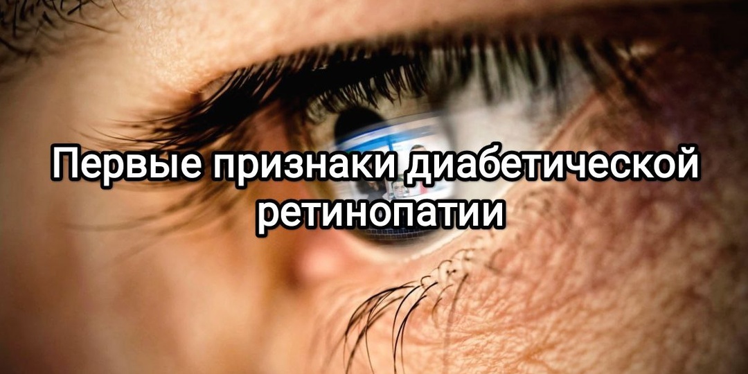 Первые признаки диабетической ретинопатии: и почему врачи диагностируют ее раньше, чем появляются симптомы у диабетика?