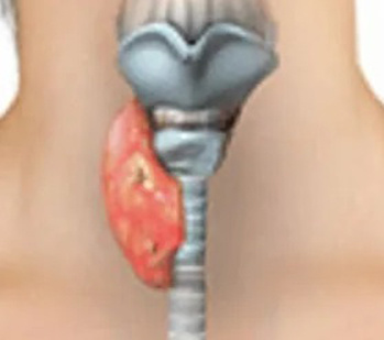 Рис. 00. изображение из свободного доступа