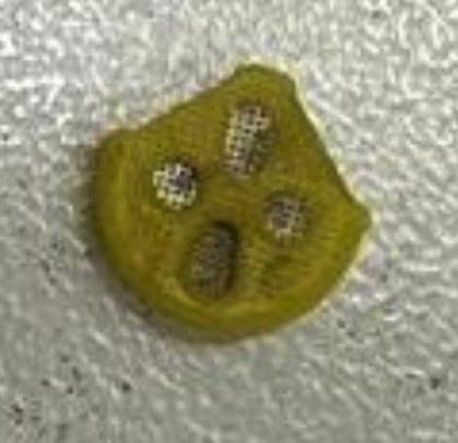 Наконечник зонда Титан. Желтый цвет указывает на налет засохшей ушной серы, который закрывает диагностические отверстия. При большом увеличении отчетливо видны отложения желтой массы. Под прокладкой находится зонд, который также был забит остатками ушной серы. Для удаления органических остатков применяется ультразвуковая очистка, которую мы проводим по регламенту 1 раз в 1-1,5 года для каждого импедансометра. 