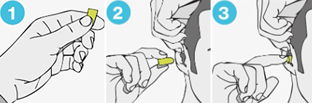 1. Скрутите между пальцами вкладыши в цилиндр 2. Наклоните голову рукой и мягко оттяните ухо в сторону и вверх для выпрямления ушного канала. 3. Вставьте вкладыш и придержите его некоторое время. Это предотвратит его выпадение при раскрытии. Если вкладыш не вылезает из уха и не виден при фронтальном обзоре, значит, он находится в идеальном положении. Чтобы убедиться в правильности установки воспользуйтесь зеркалом. Если вкладыш не удается вставить должным образом, попробуйте другой размер.