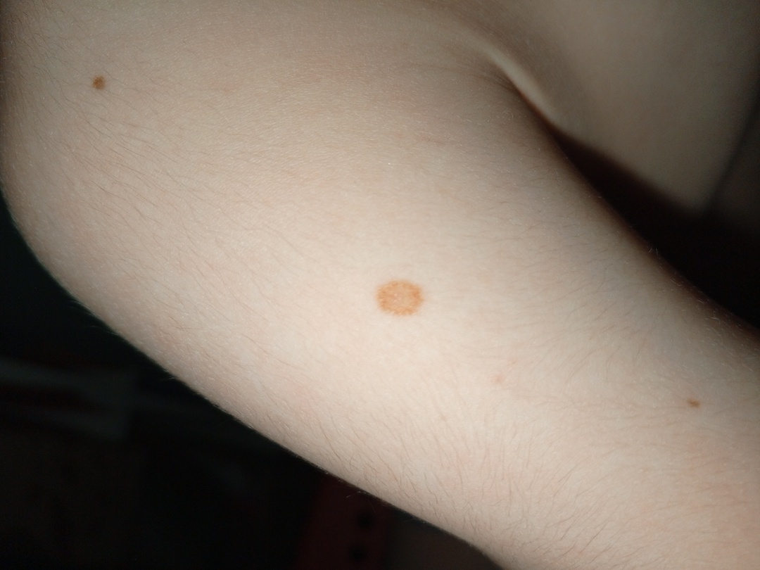 Сёмкино плечо