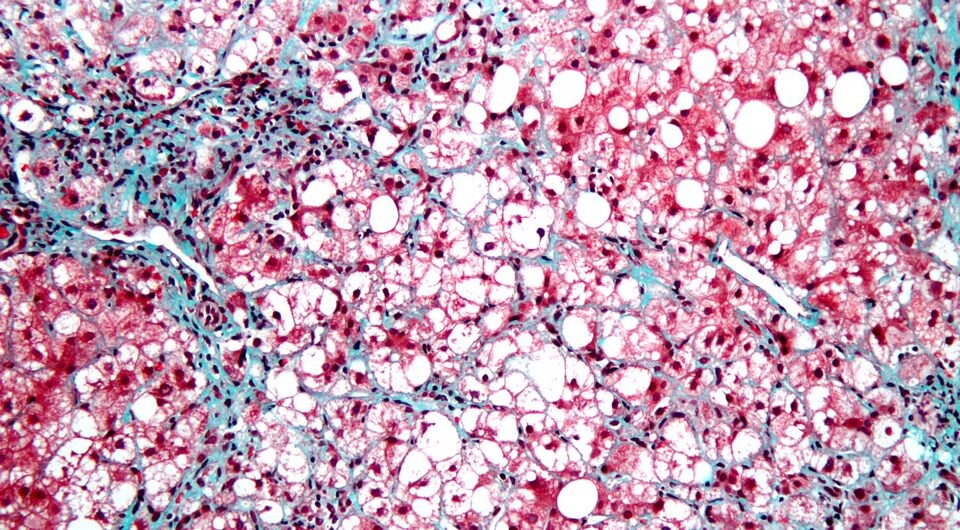   Nephron / Wikimedia Commons / CC-BY-SA-3.0