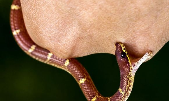 Укусила змея! Что делать?