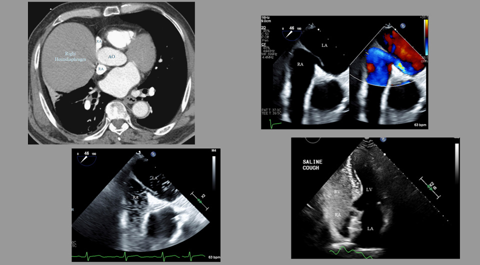  Georg Gussak et al. / BMJ Case Reports, 2025