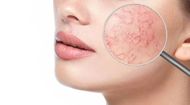 Фото: интернет