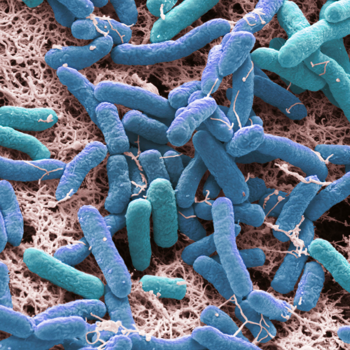   Синегнойная палочка