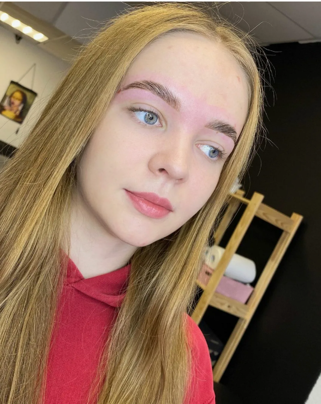-2