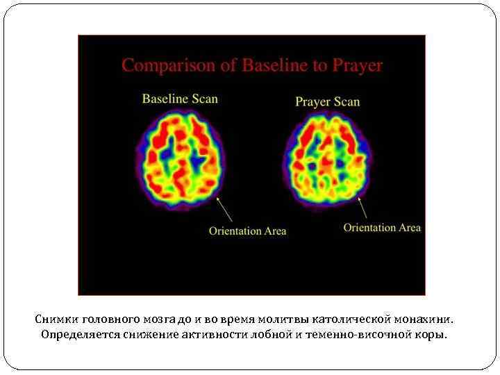 Мозг человека во время молитвы нейробиология