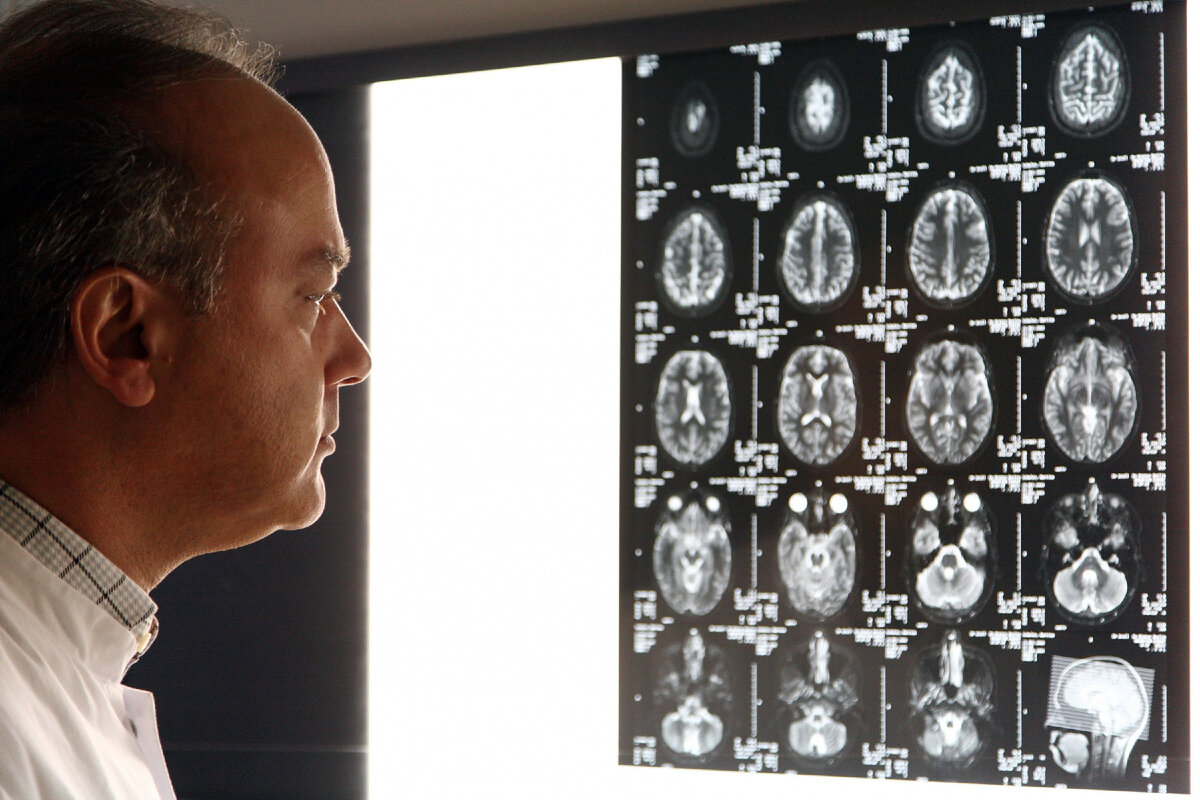 мозг после клинической смерти нейробиология